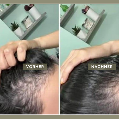 Roséa Deep Cleanse Scalp Scrub N°04